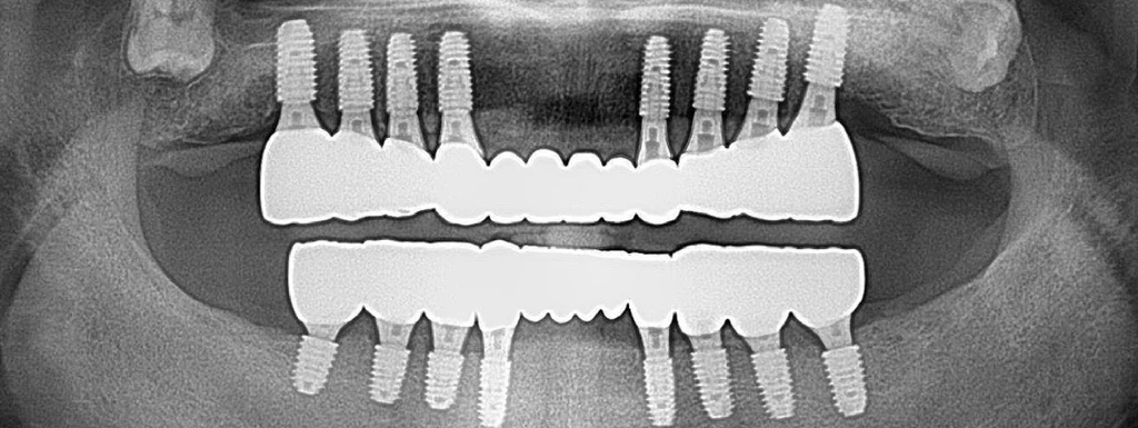 before_image