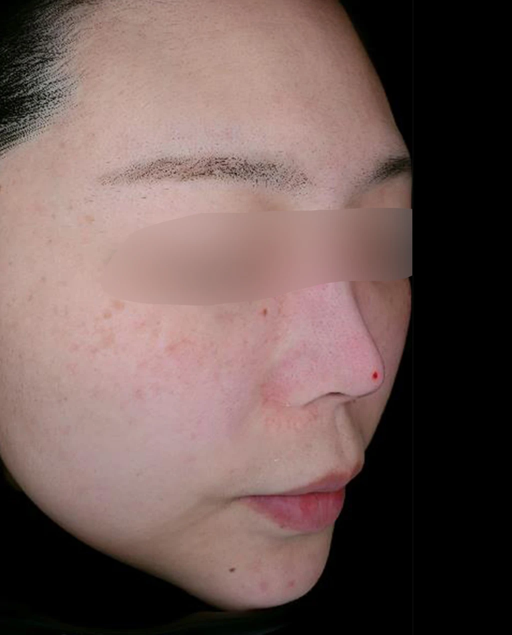 before_image