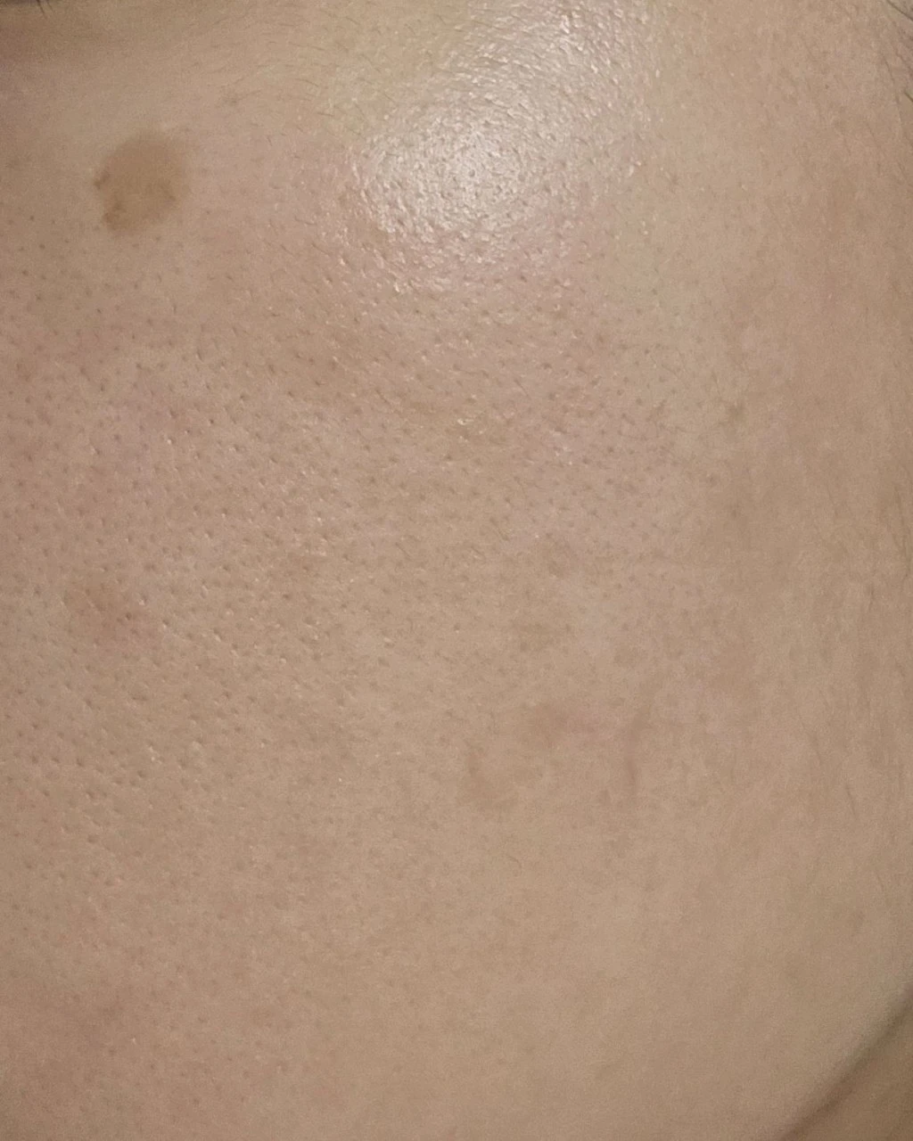 before_image