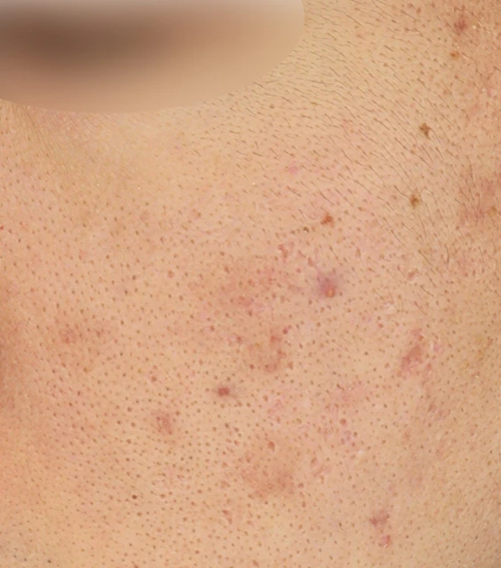 before_image