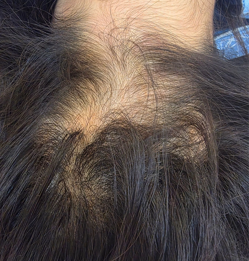 before_image