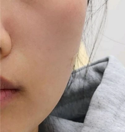 before_image