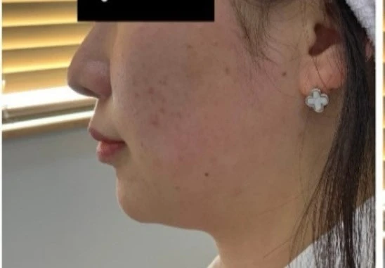 before_image