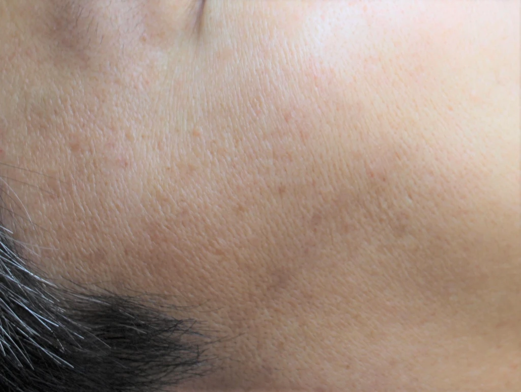 before_image