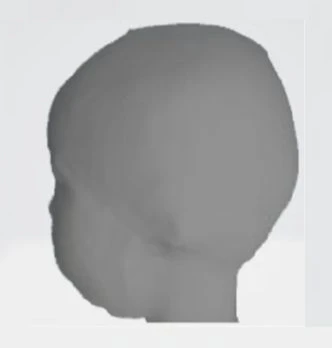 before_image