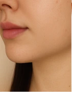 before_image