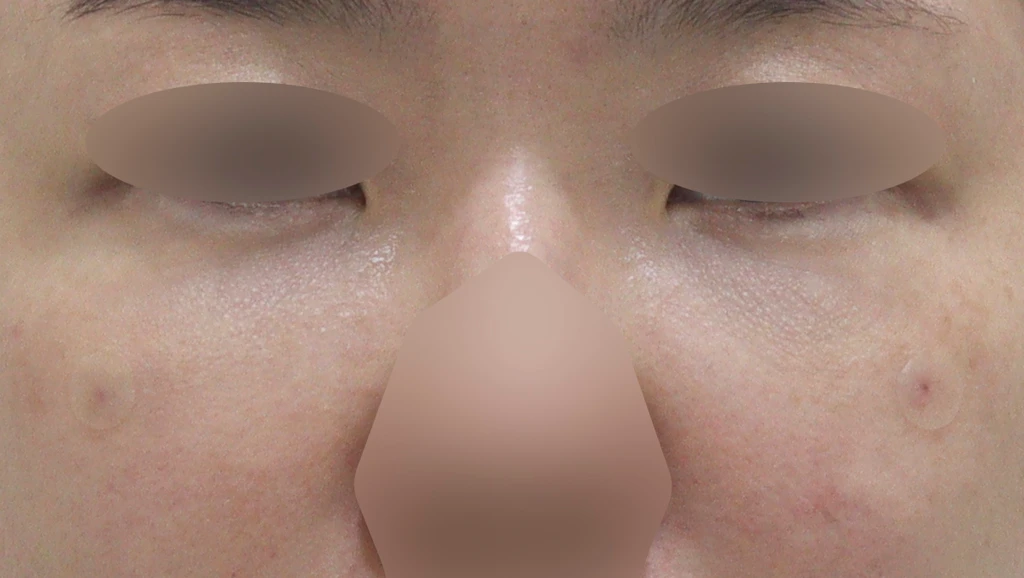 before_image