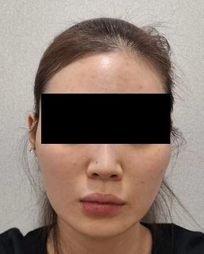 before_image