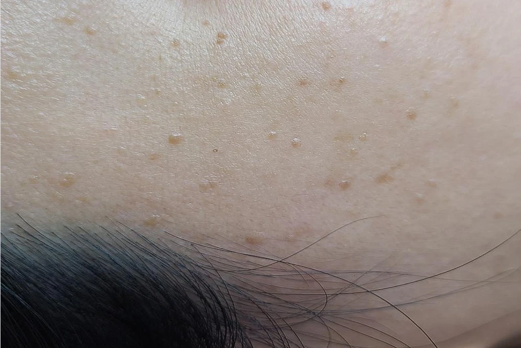 before_image