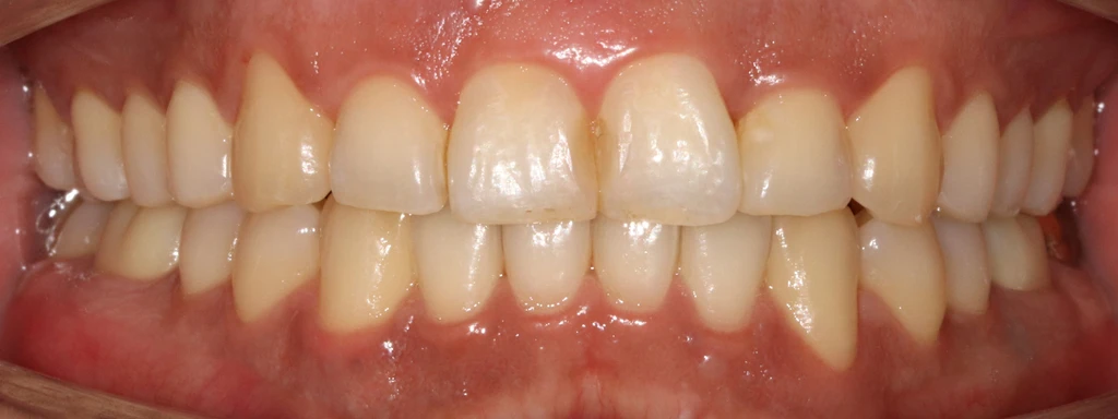 before_image