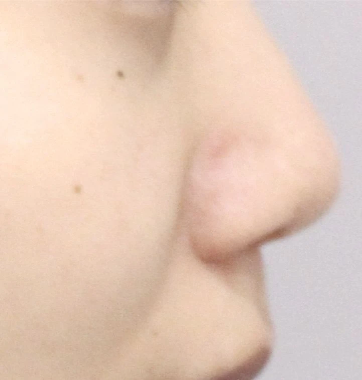 before_image