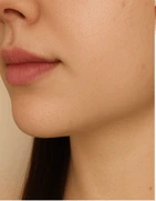 before_image