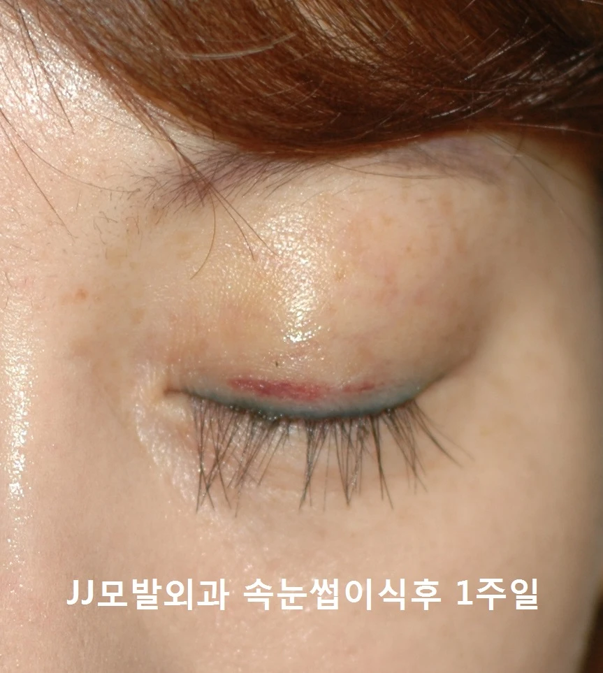 before_image