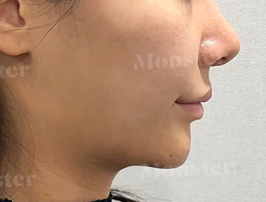 before_image