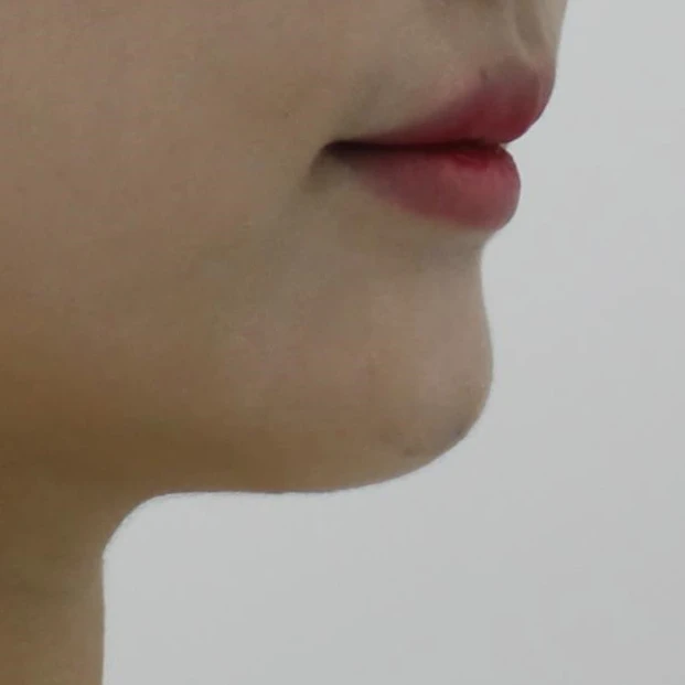before_image