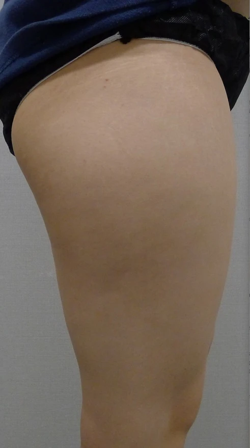 before_image