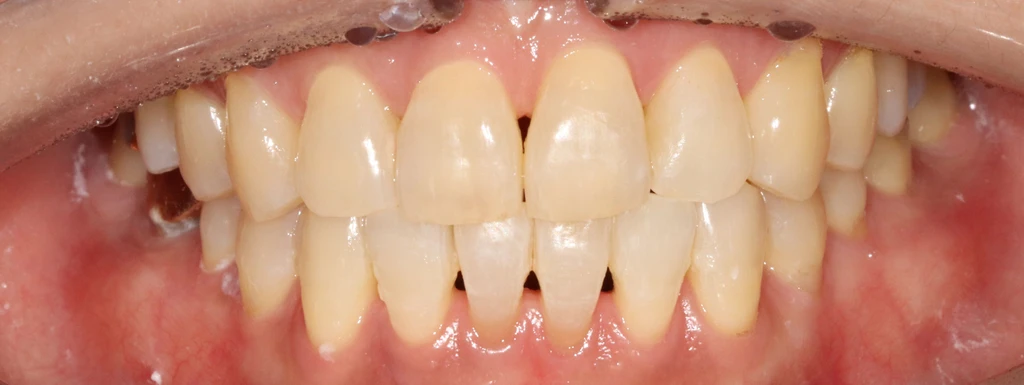 before_image