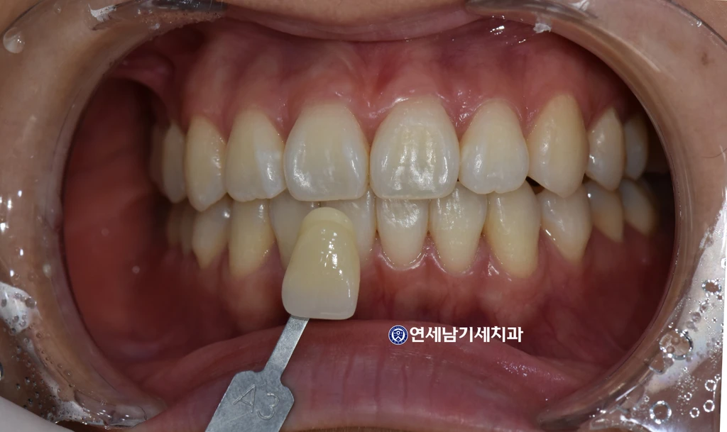 before_image