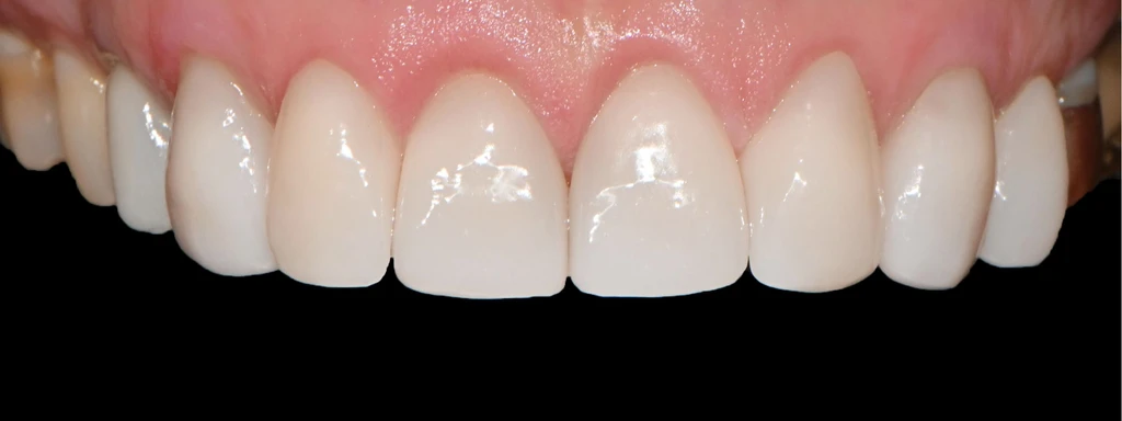 before_image