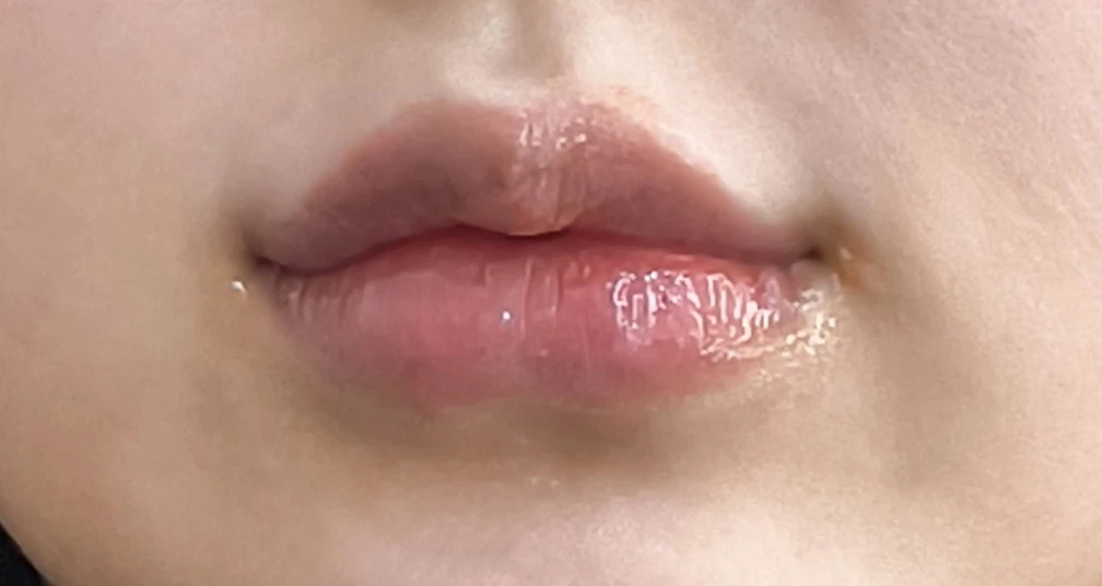 before_image