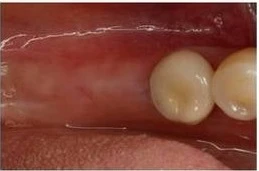 before_image