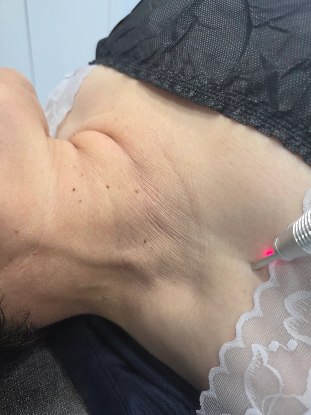 before_image