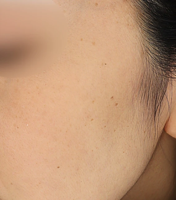 before_image
