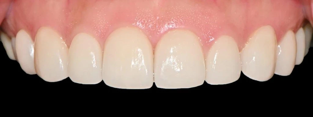 before_image