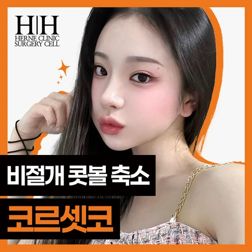 treatment-event-thumbnail