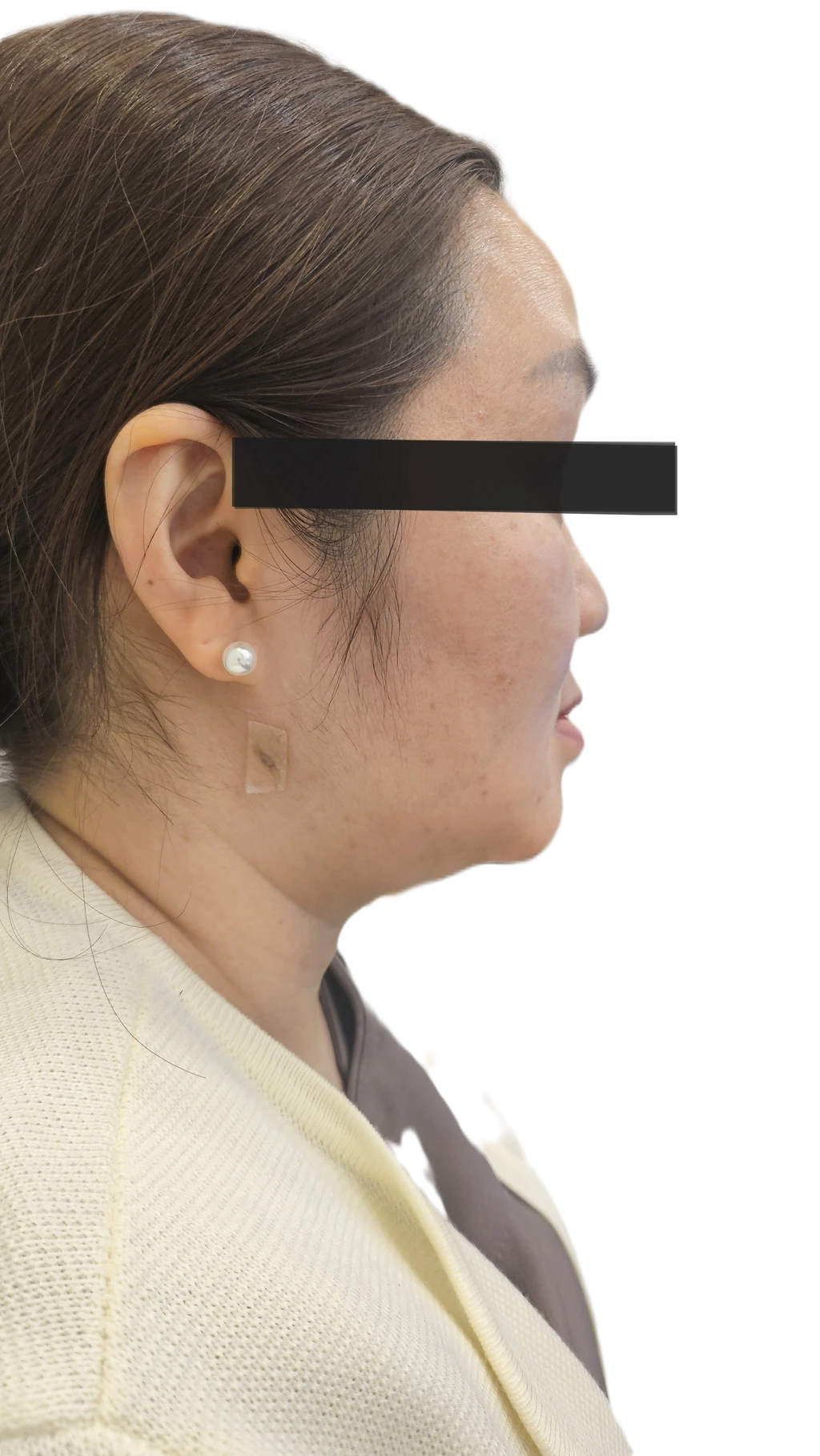 before_image