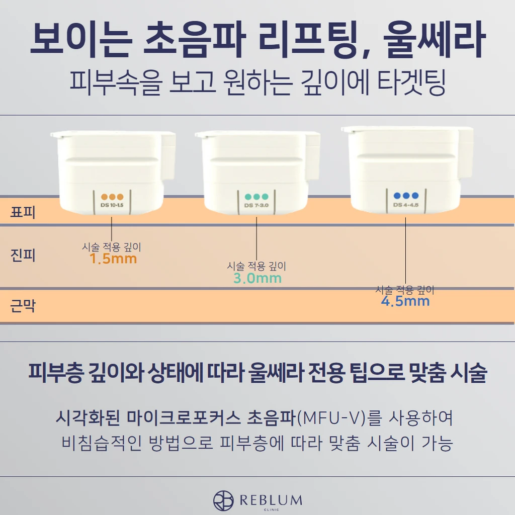 treatmentIntroduction