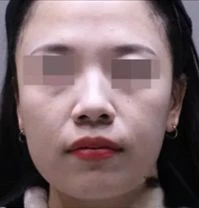 before_image