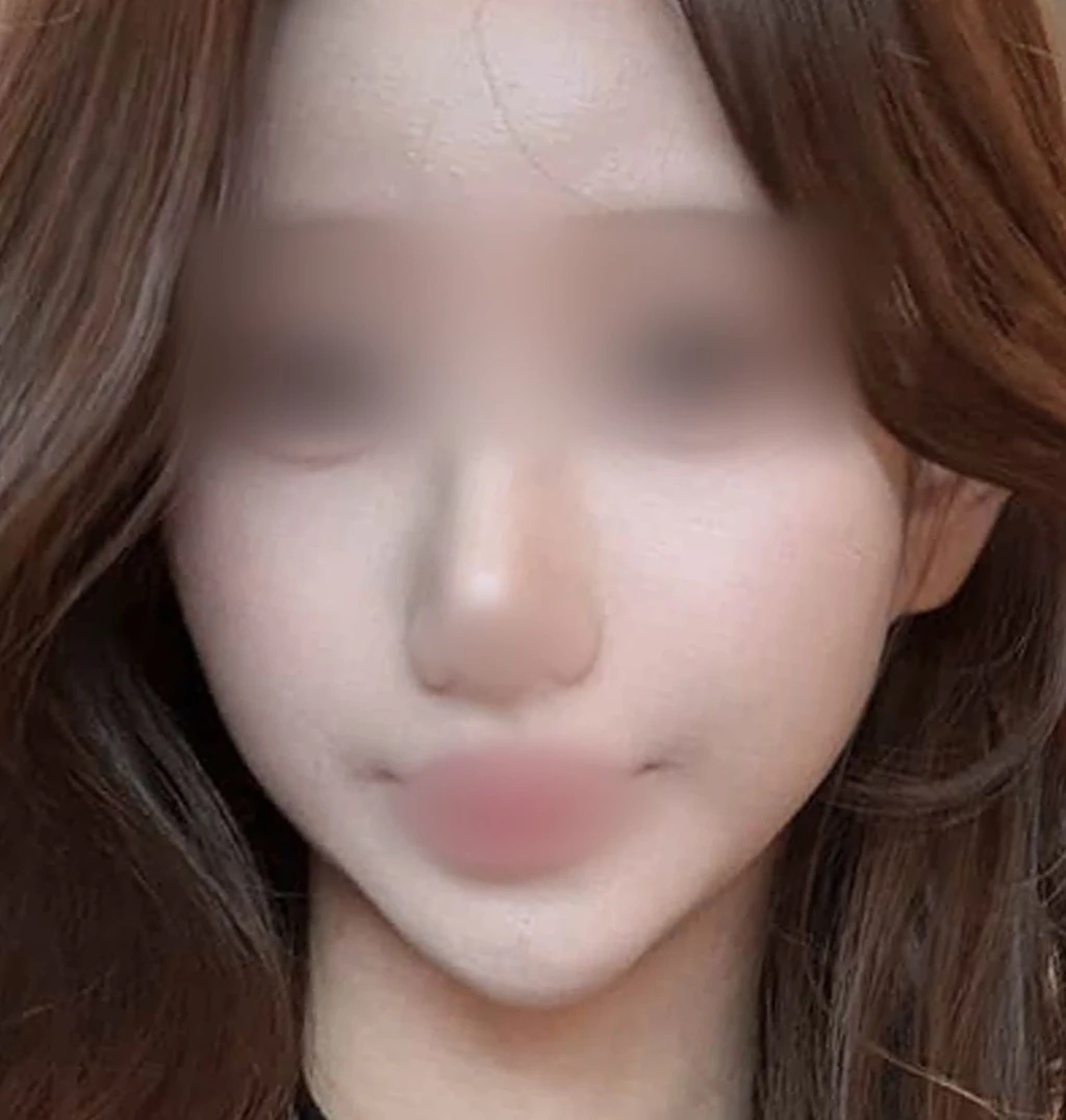 before_image