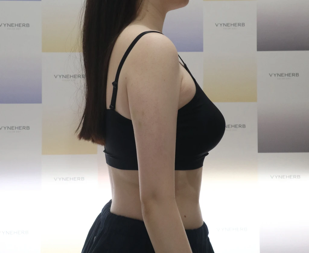 before_image