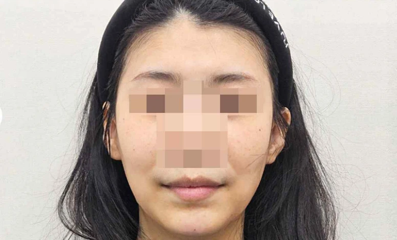before_image