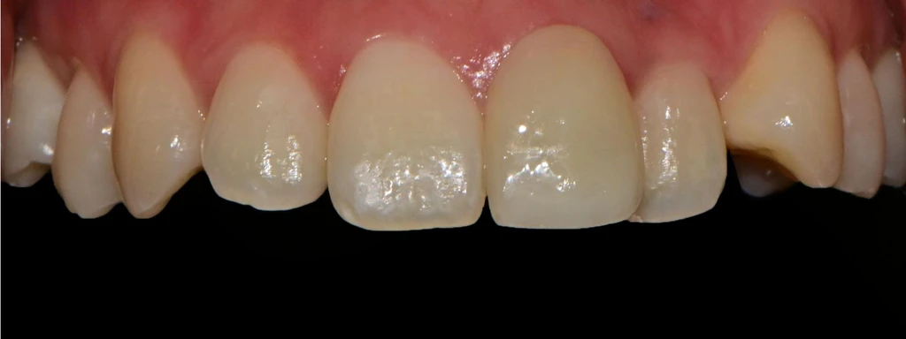 before_image