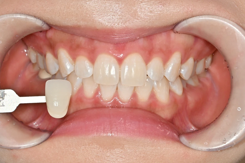 before_image