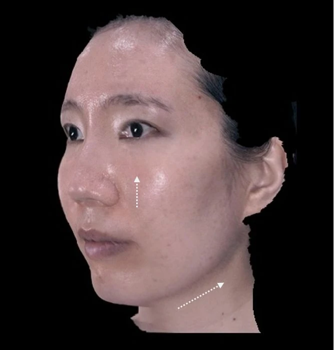 before_image