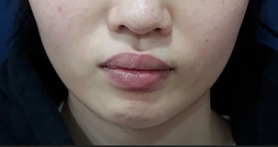 before_image