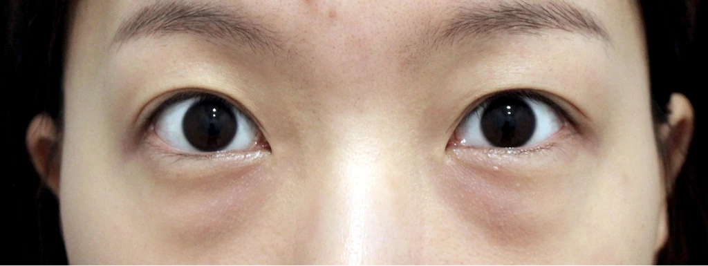 before_image