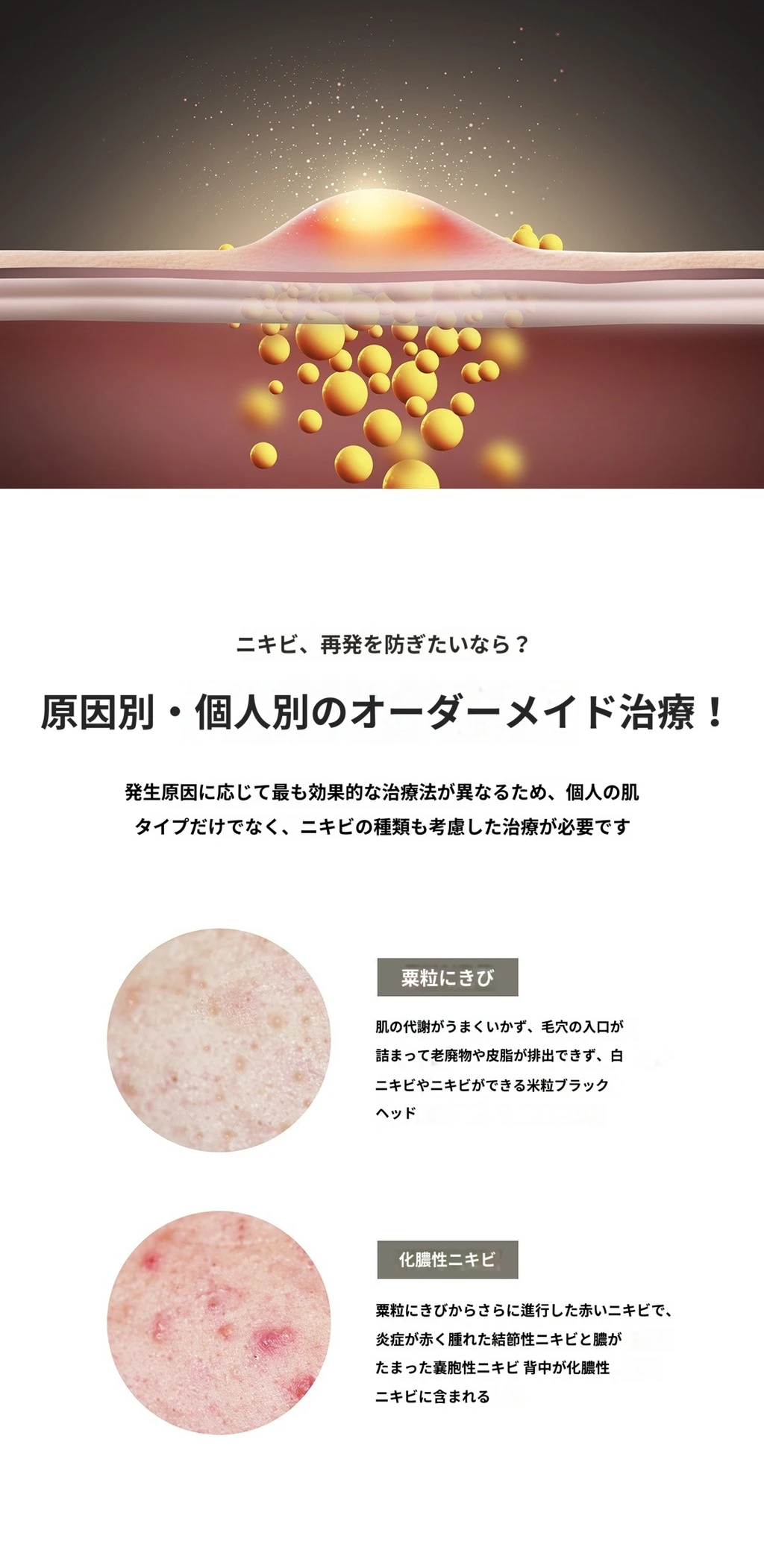 treatmentIntroduction