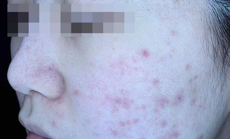 before_image