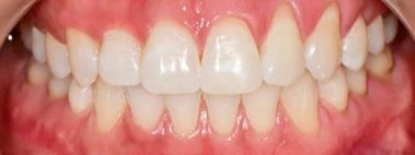 before_image