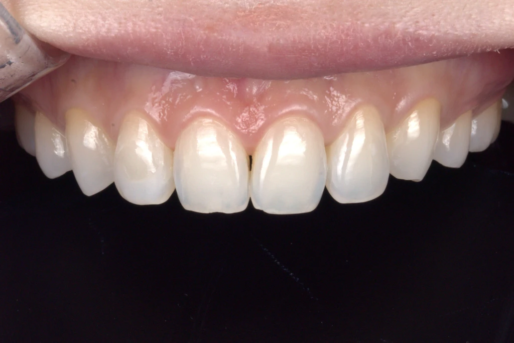before_image
