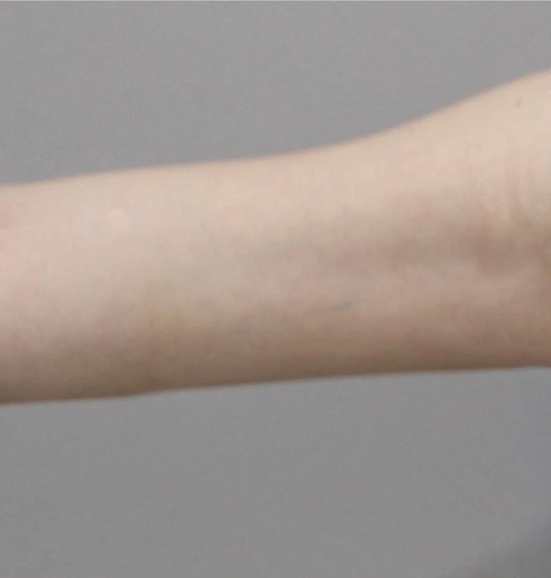 before_image
