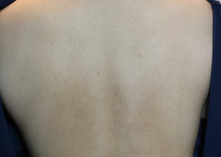 before_image