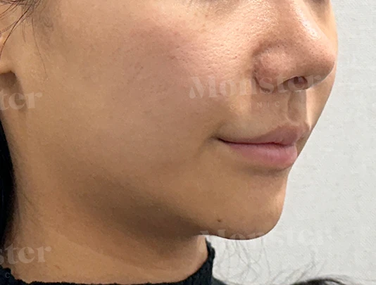 before_image