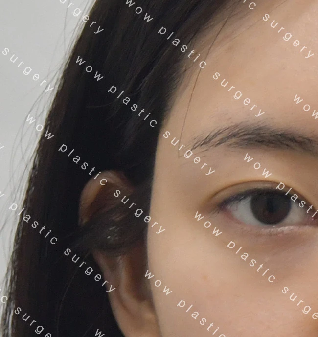 before_image
