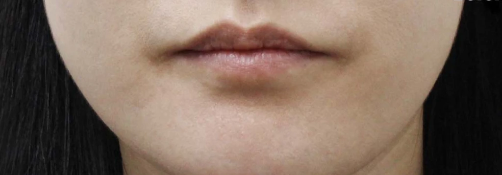 before_image