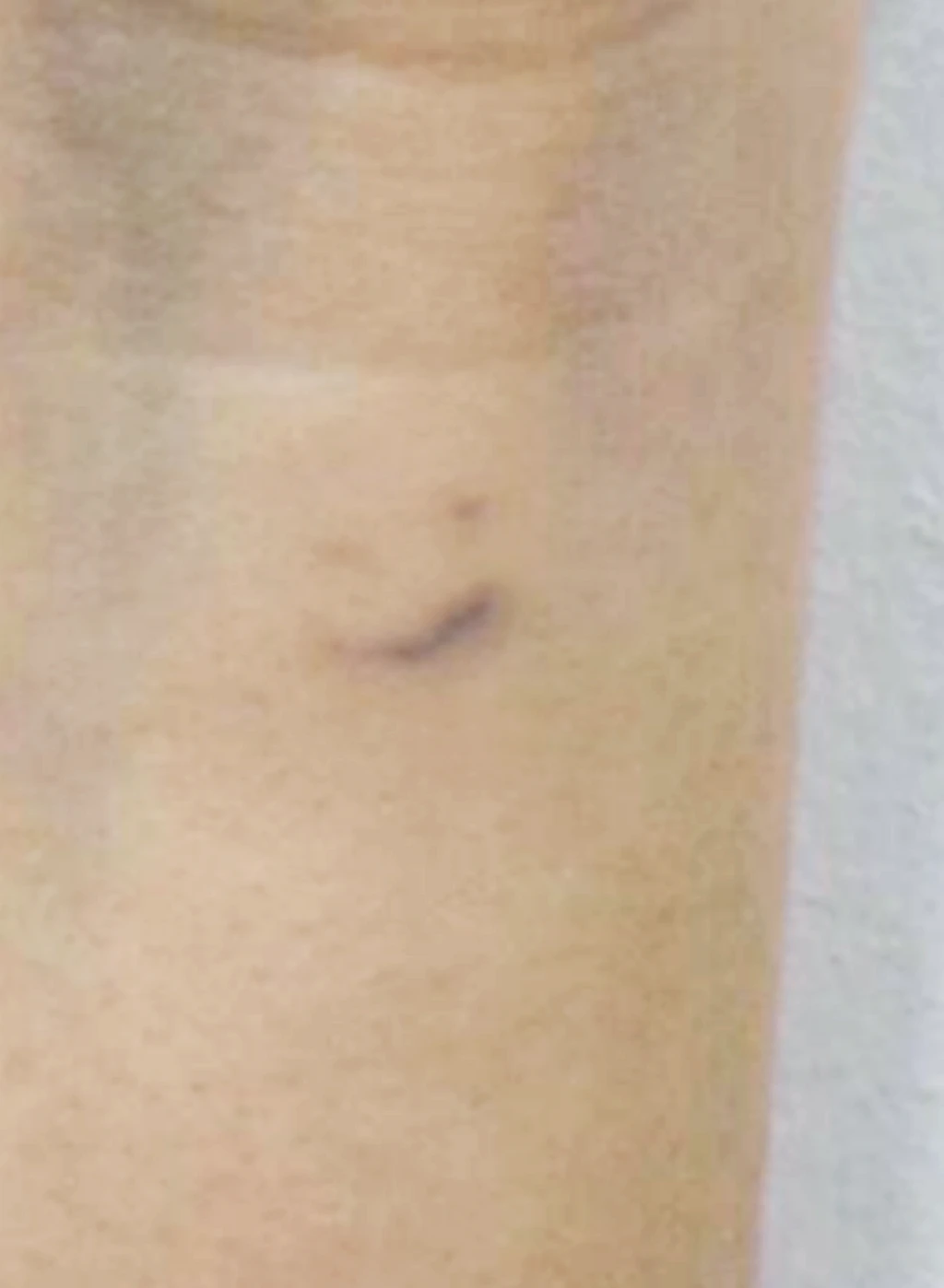 before_image